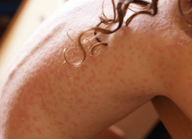 Close-up of a human skin with goosebumps and fine hair.