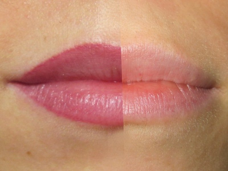 Tattooing for enhancing lips in Brisbane